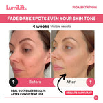 Load image into Gallery viewer, GlowLUXE™ — Clinic-Grade LED Therapy at Home