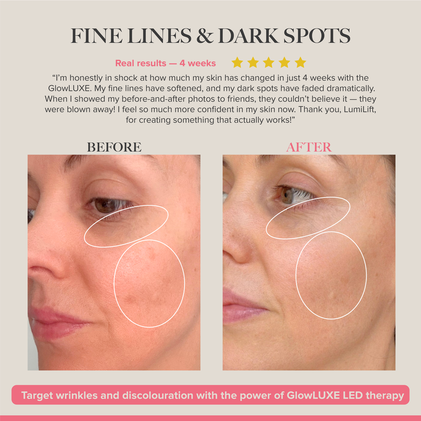 GlowLUXE - 7 Light LED Device