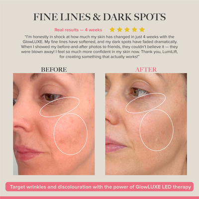 GlowLUXE - 7 Light LED Device