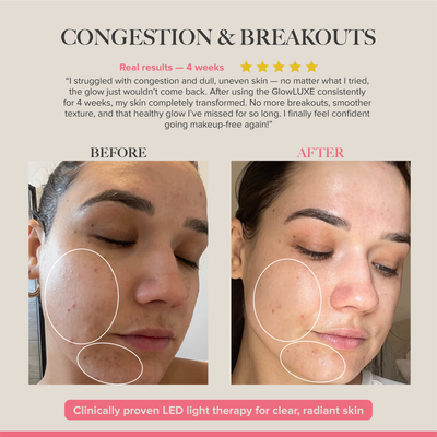 GlowLUXE - 7 Light LED Device